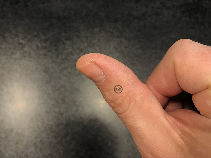 Fotografie palce po vyléčení kožní praskliny po 9 dnech | Kožní praskliny na prstech | Rady ze života
